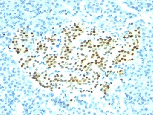 NKX2.2 (Neuroendocrine & Ewing Sarcoma Marker) Antibody