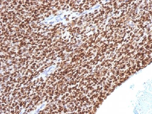 NKX2.2 (Neuroendocrine & Ewing's Sarcoma Marker) Antibody