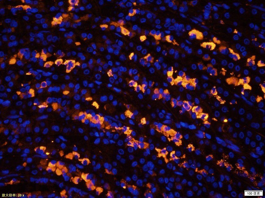 NKX2-5 antibody