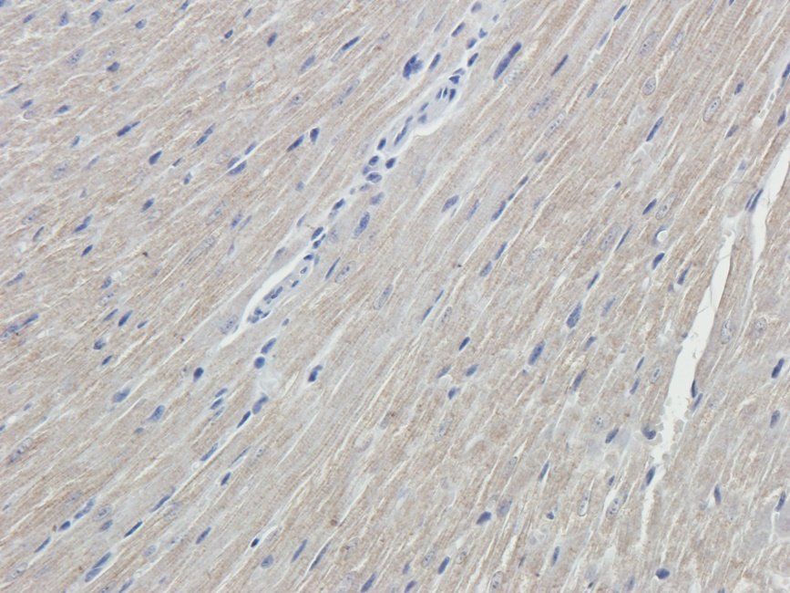 NKX2-5 antibody