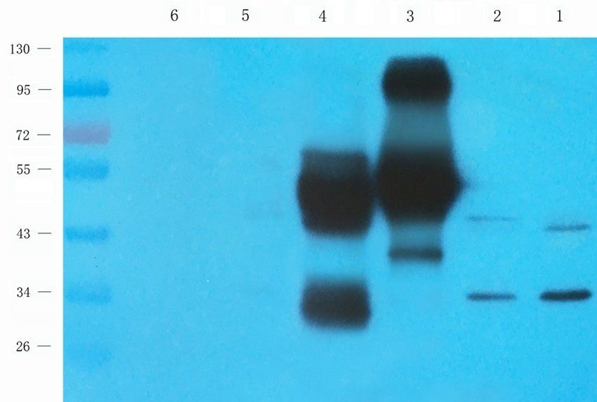 NKX2-5 antibody