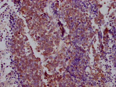 NKX2-1 Recombinant Monoclonal Antibody