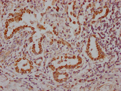 NKX2-1 Recombinant Monoclonal Antibody