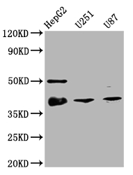 NKX2-1 Recombinant Monoclonal Antibody