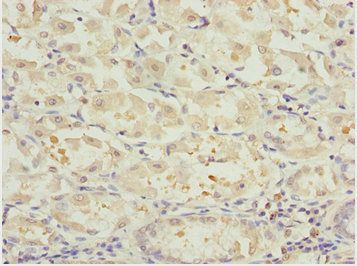 NLE1 Antibody