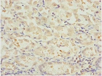 NLE1 antibody