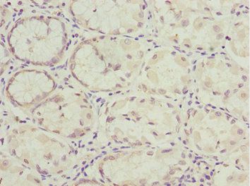 NLE1 Antibody
