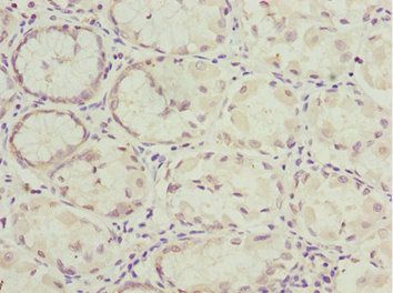 NLE1 antibody