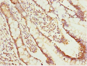 NLE1 Antibody