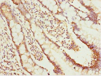 NLE1 antibody