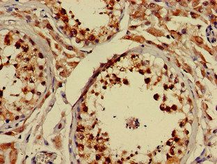 NLGN1 antibody