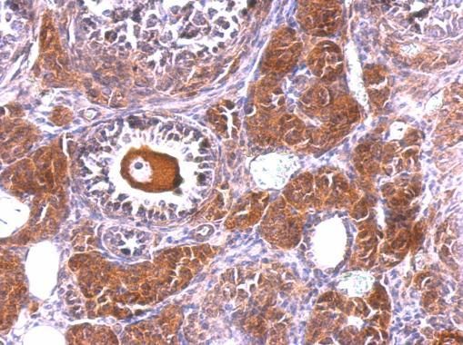 NLK antibody [N3C3]