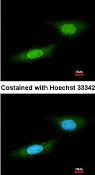 NLK antibody