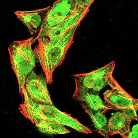 NLRC4 (phospho-Ser-533)