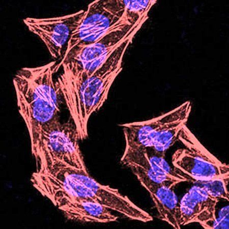 NLRC4 (phospho-Ser-533)