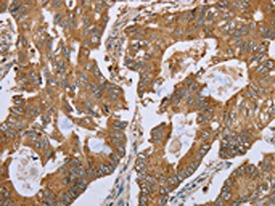 NLRP10 Antibody