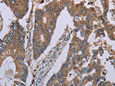 NLRP12 antibody