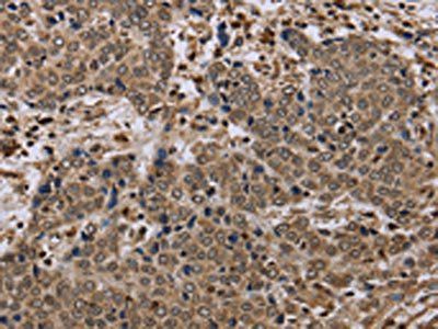 NLRP4 antibody