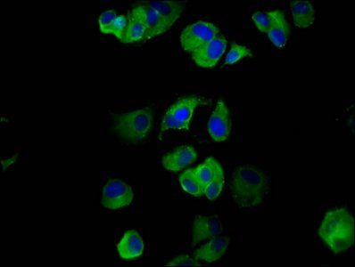 NLRP6 antibody