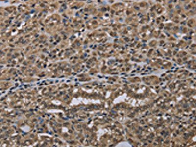 NLRP6 antibody