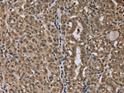 NLRP6 antibody