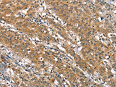 NLRP7 Antibody