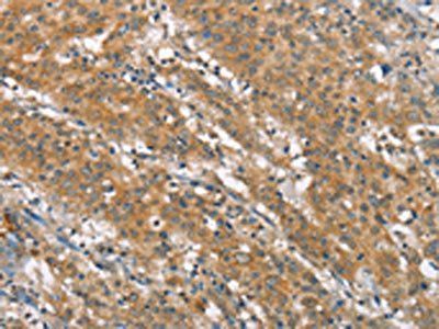 NLRP7 antibody