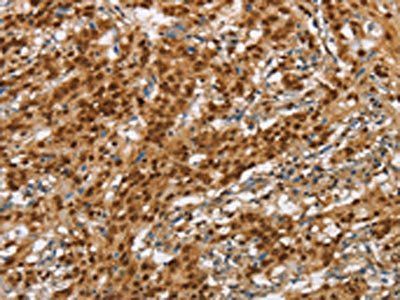 NLRP7 antibody