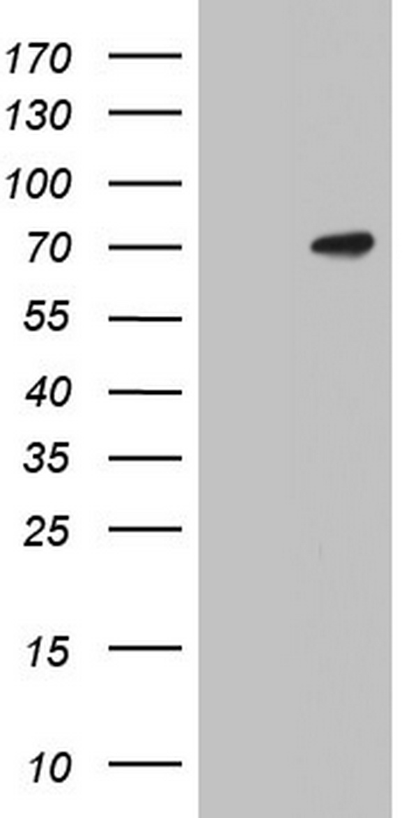 NM23A Antibody