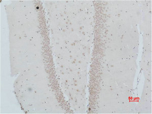 NMBR antibody