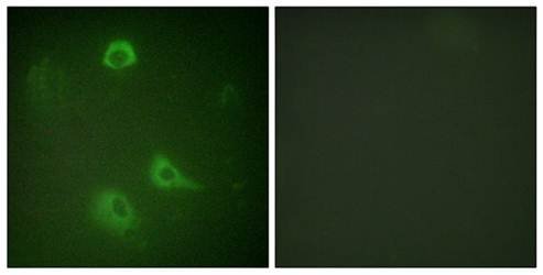 P4HB antibody