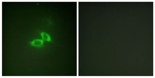 NMDAR1 (Ab-890) Antibody