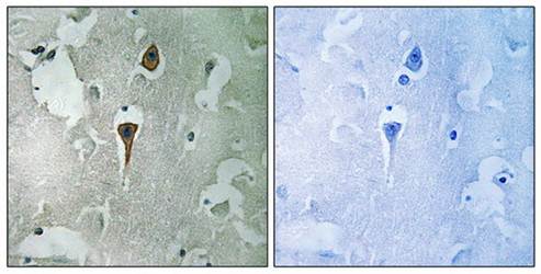 NMDAR1 (Ab-890) Antibody