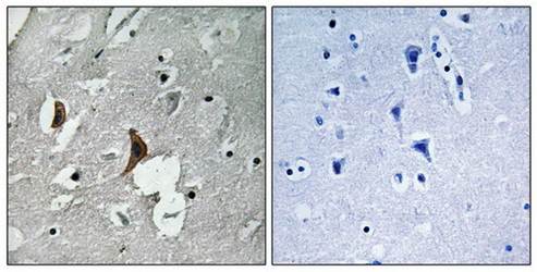 NMDAR2B (Phospho-Tyr1336) Antibody