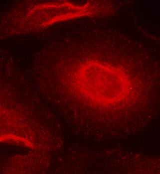 NMDAR2B Rabbit Polyclonal Antibody