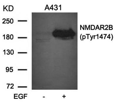 NMDAR2B (phospho-Tyr1474) Antibody