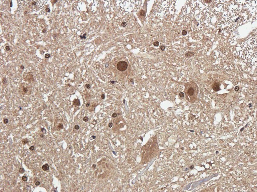 NMDE2 antibody