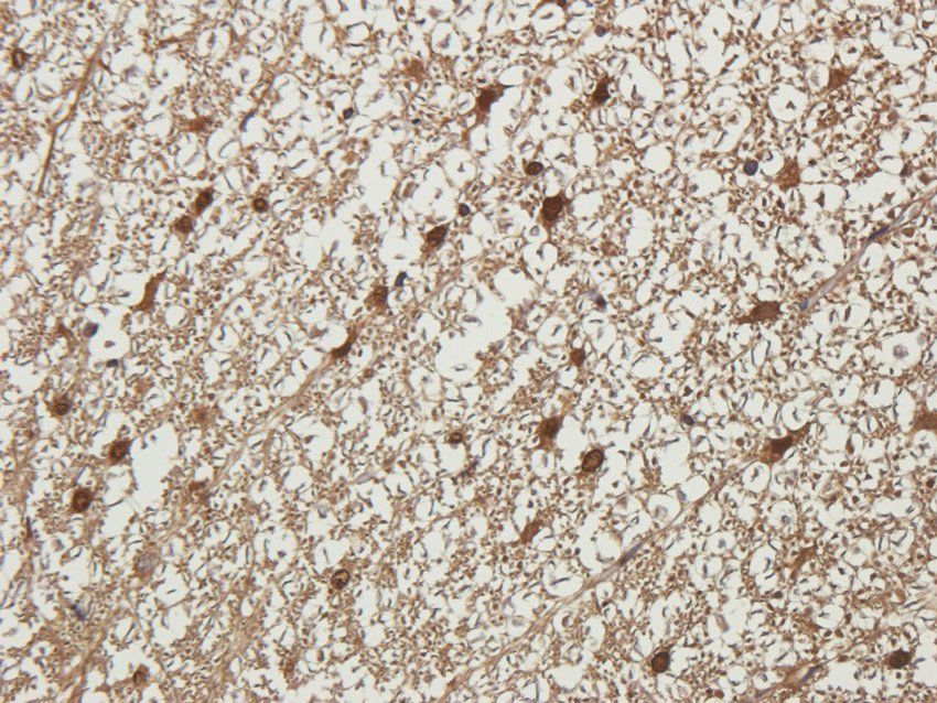 NMDE2 antibody