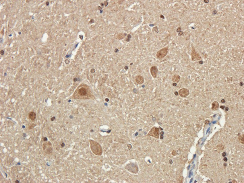 NMDE2 antibody