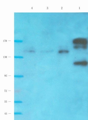 NMDE2 antibody