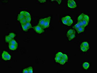 NME3 antibody