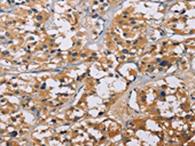 NME5 Antibody