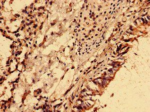 NME6 Antibody