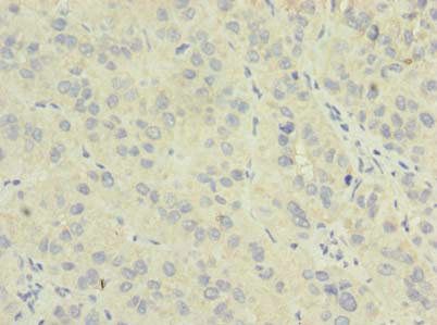 NME7 Antibody