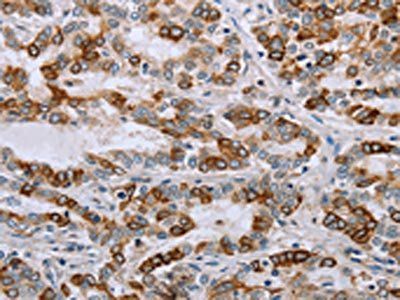NMT1 Antibody