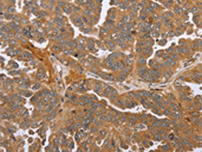 NMT1 Antibody