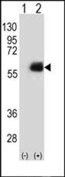 NMT2 antibody