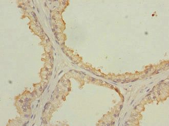 NMT2 Antibody