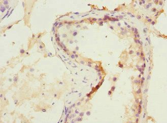 NMT2 Antibody
