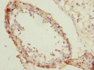 NMT2 Antibody